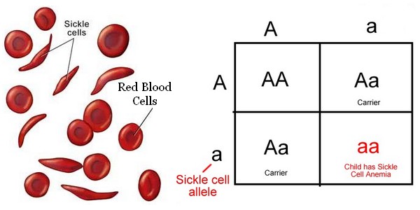 Sickle Cell Anemia Worksheet