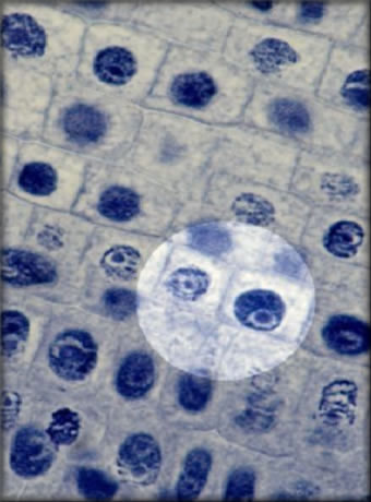 Onion Root Tip Showing Mitosis