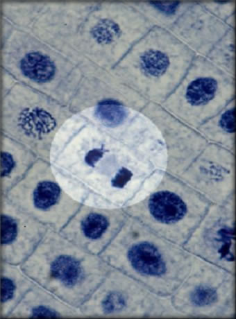 Onion Root Tip Showing Mitosis