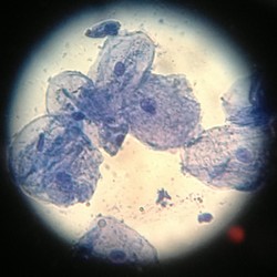 bacterial cells under microscope 400x