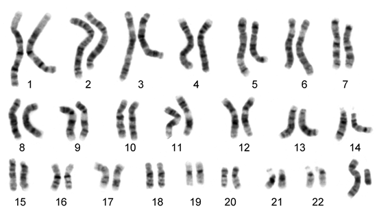 12 1 Chromosomal Inheritance