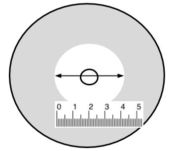 zone of inhibition