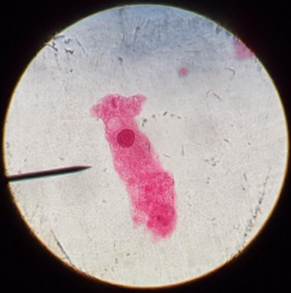 How to Study Protists like the Amoeba and Euglena