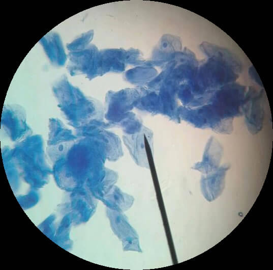 cheek cells under a microscope